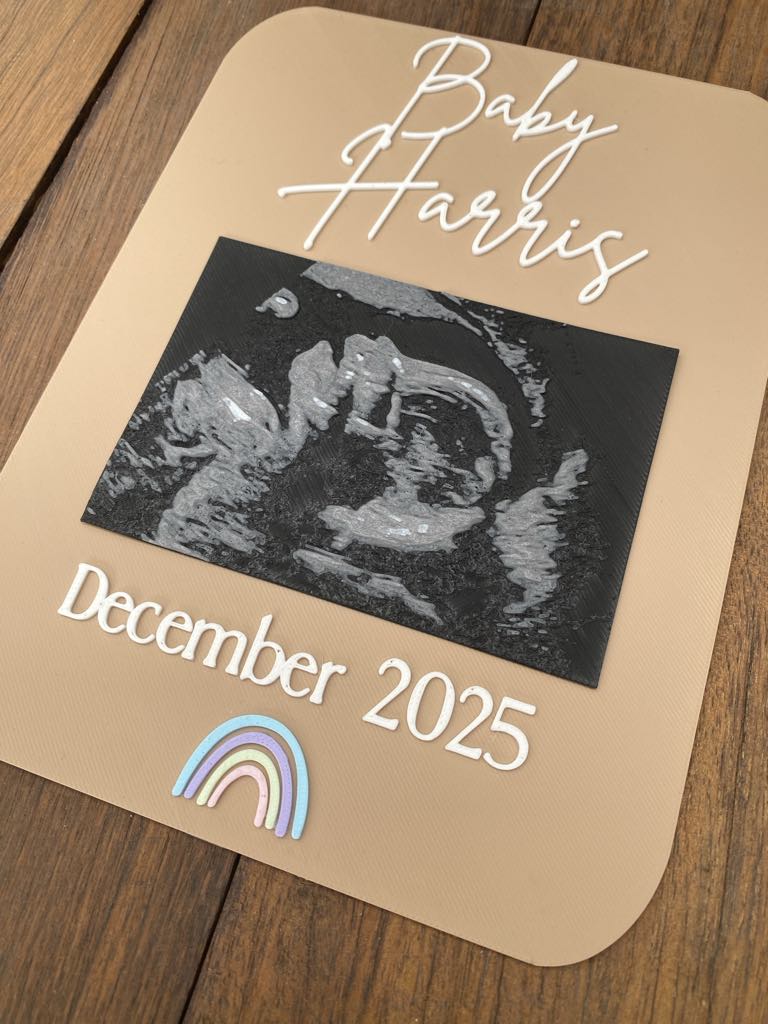 Pregnancy Announcement 3D Sonogram - Image 2